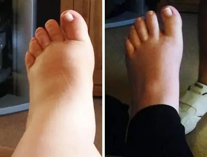 Kund upplever mindre värk med NordHeal