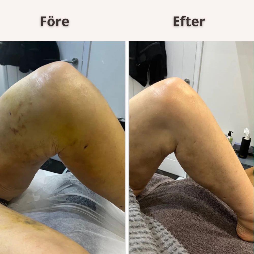 Circulation Pro™ - NordHeal