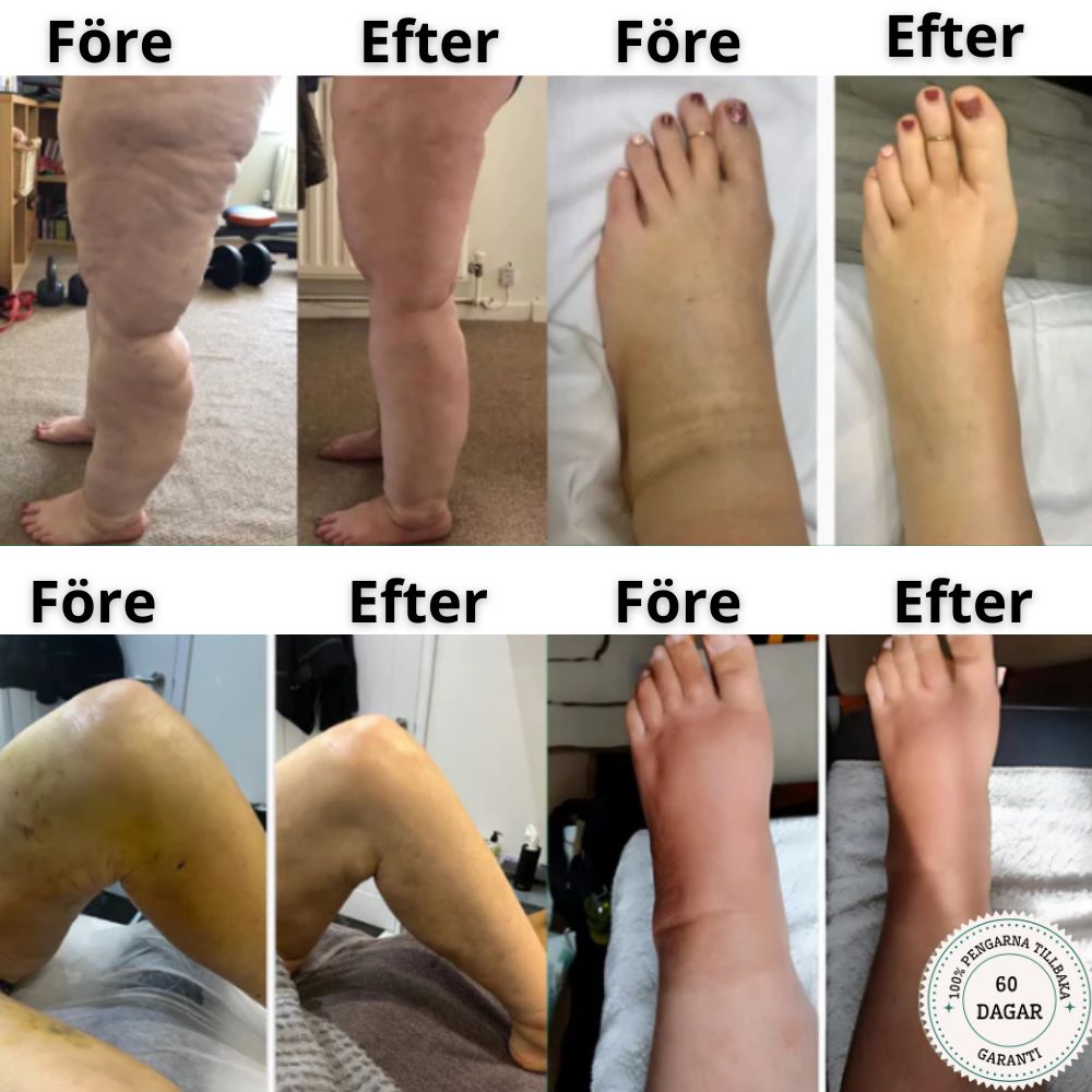 Circulation Pro™ - NordHeal