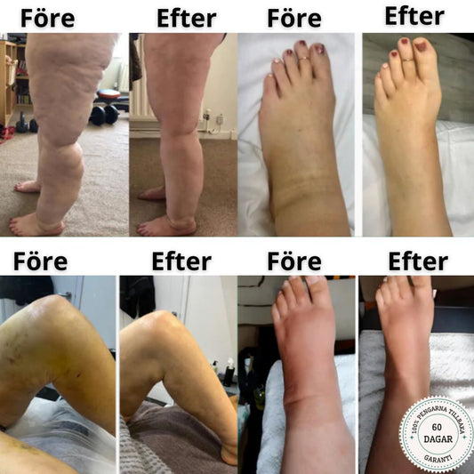 Circulation Pro™ - NordHeal